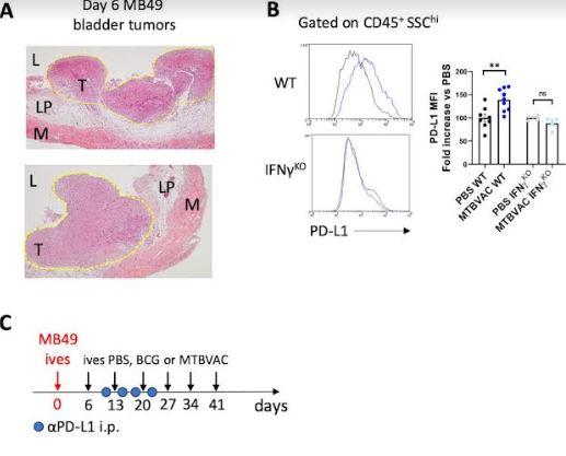 Novel intravesical bacterial immunotherapy induces rejection of BCG-unresponsive established bladder tumors